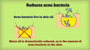 Read more about the article How Accutane Works for You