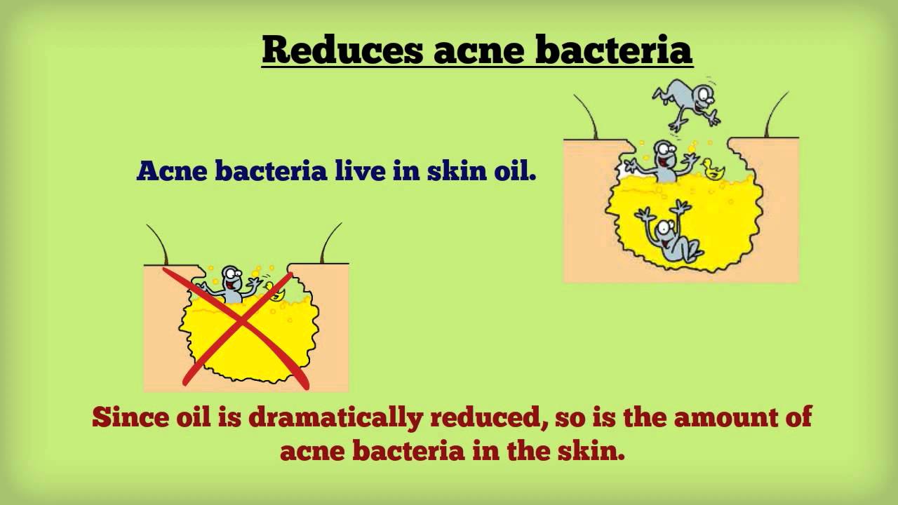 You are currently viewing How Accutane Works for You