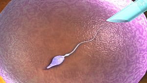 Read more about the article How Does Intracytoplasmic Sperm Injection Work? ICSI IVF Procedure for Pregnancy Animation Video