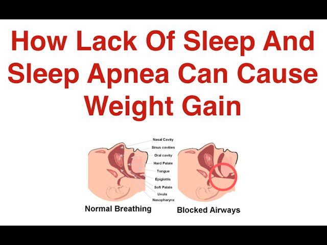 You are currently viewing How Lack Of Sleep And  Sleep Apnea Can Cause Weight Gain