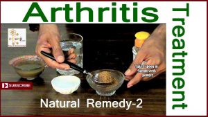 Read more about the article How To Cure Arthritis – Home Remedies for Arthritis – Arthritis Treatment – ekunji