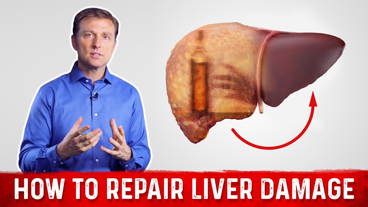 You are currently viewing How To Repair Liver Damage After Alcohol?: Dr.Berg on Liver Cirrhosis
