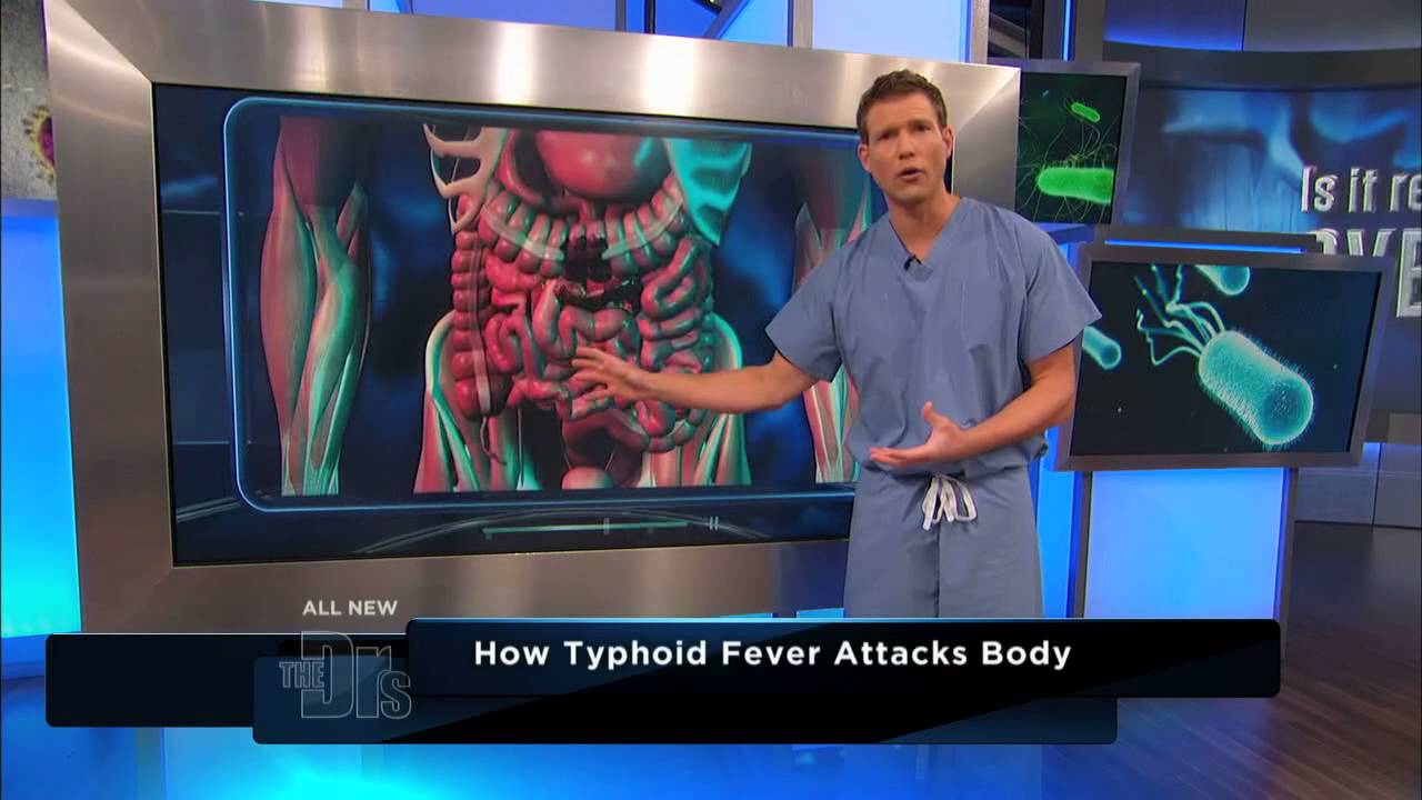 You are currently viewing How Typhoid Fever Affects the Body — The Doctors