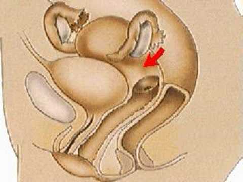 You are currently viewing How the Body Works : Female Reproductive Organs