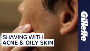 Read more about the article How to Shave with Acne and Oily Skin | Men’s Skin Care Tips