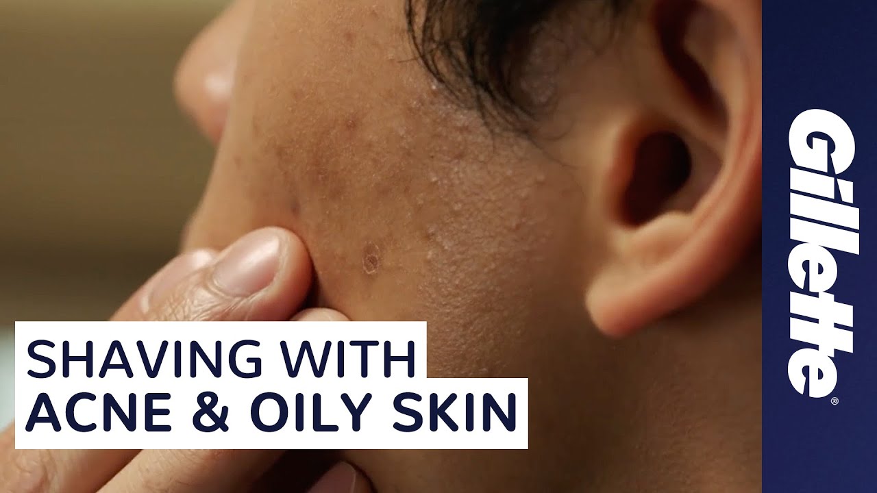 You are currently viewing How to Shave with Acne and Oily Skin | Men’s Skin Care Tips