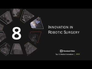 Robotics Surgeries Video – 1