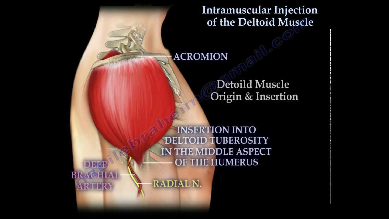 You are currently viewing Intramuscular injection of the deltoid muscle  – Everything You Need To Know – Dr. Nabil Ebraheim