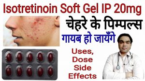 Isotroin Capsule Review in Hindi || by Mt Discuss