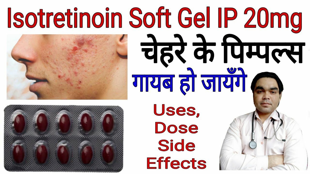You are currently viewing Isotroin Capsule Review in Hindi || by Mt Discuss