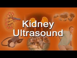 Read more about the article Kidney Ultrasound – What Is It? Does It Hurt?
