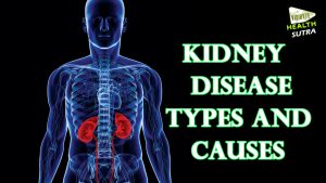 Read more about the article Kidney disease   types and causes –  Health Sutra