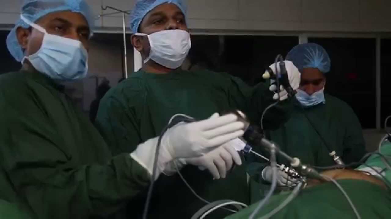 You are currently viewing Laproscopic Surgeries Video – 1