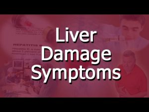 Read more about the article Liver Damage Symptoms