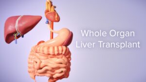 Organ Transplantation Surgeries Video – 3