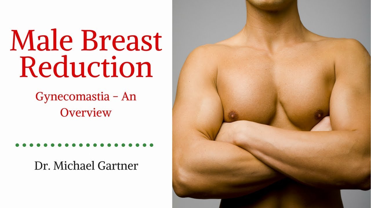 You are currently viewing Male Breast Reduction (Gynecomastia) | Dr. Michael Gartner