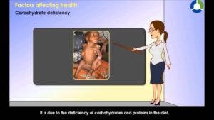 Malnutrition & Nutritional Deficiency Diseases Video – 2