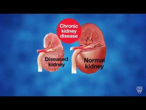 You are currently viewing Mayo Clinic Minute: Innovative research to fight kidney disease