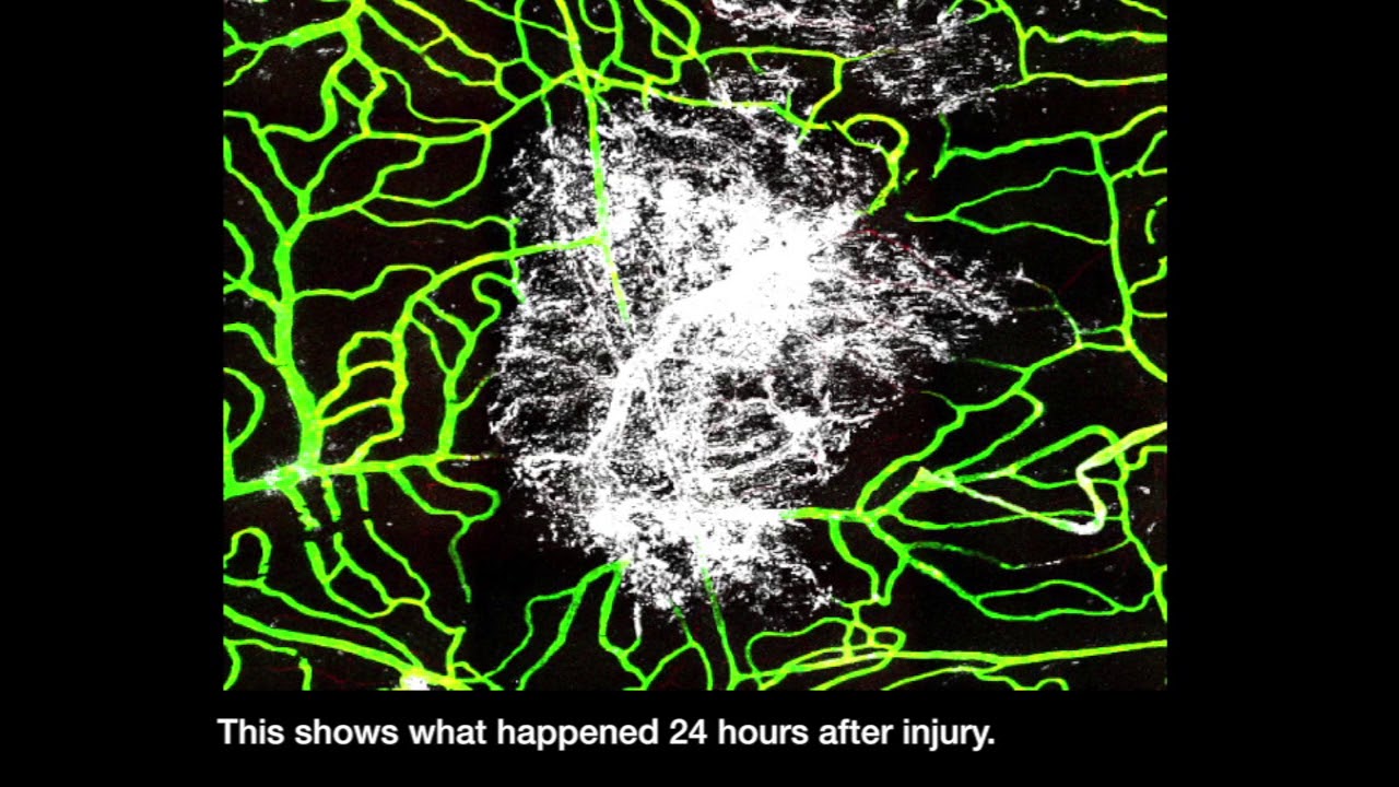 You are currently viewing Brain Injury Medicine Video – 1