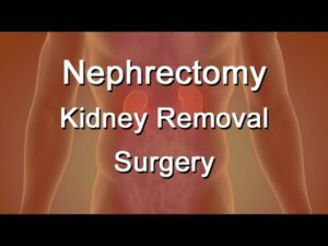 Nephrology Surgeries Video – 2