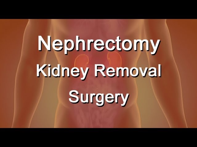 You are currently viewing Nephrology Surgeries Video – 2