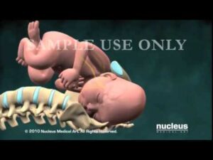 Obstetrics Video – 4