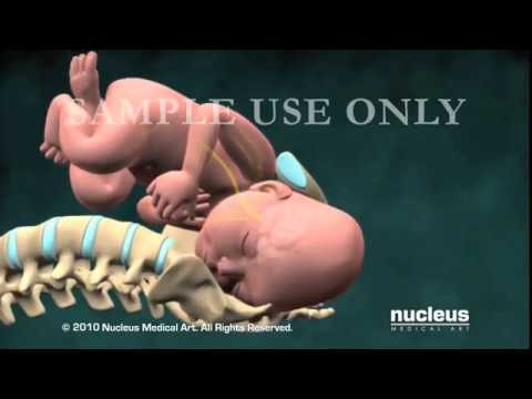 You are currently viewing Obstetrics Video – 4