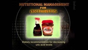 Read more about the article Nutritional Management for Arthritis in English – Diet Tips,  Nutrition Supplements