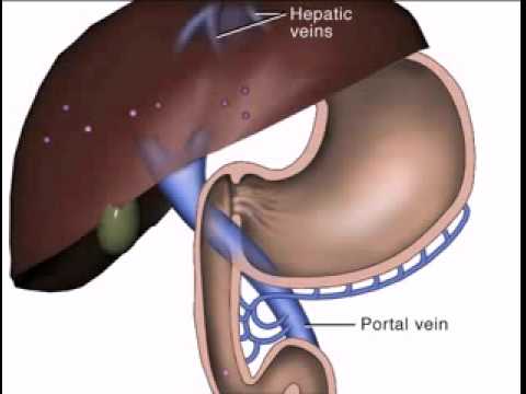 You are currently viewing Oral drug absorption.flv