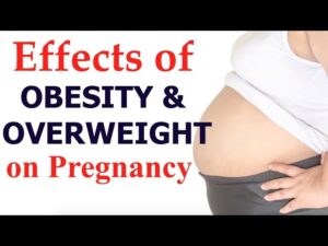 Read more about the article Overweight & Obesity Video – 22