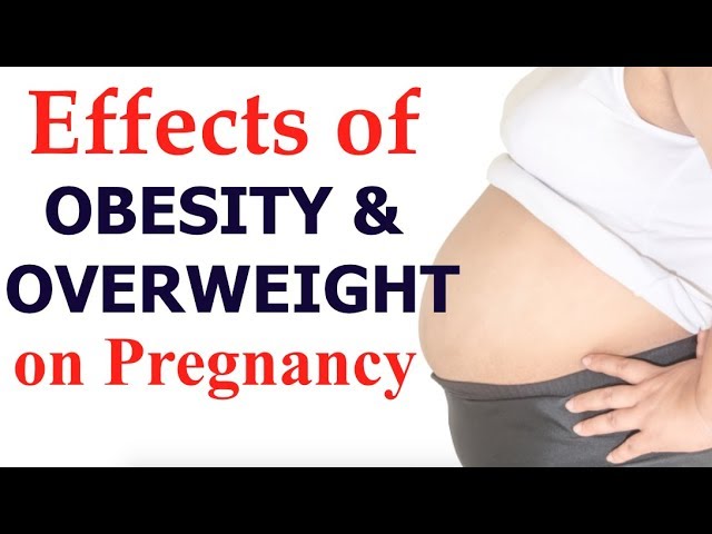 You are currently viewing Overweight & Obesity Video – 22