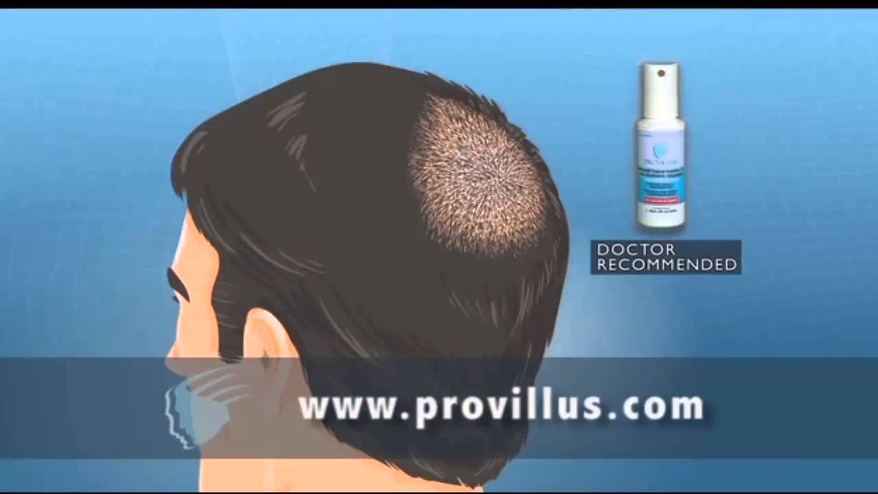 You are currently viewing Provillus Spray for Men Hair Loss Treatment Reviews