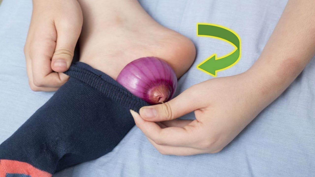 You are currently viewing Put Onion in your socks And This will Happen