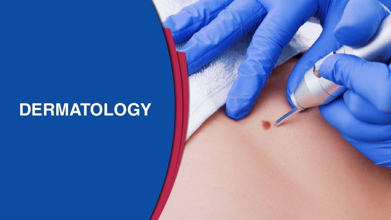 You are currently viewing Dermatology/Skin Surgeries Video – 5