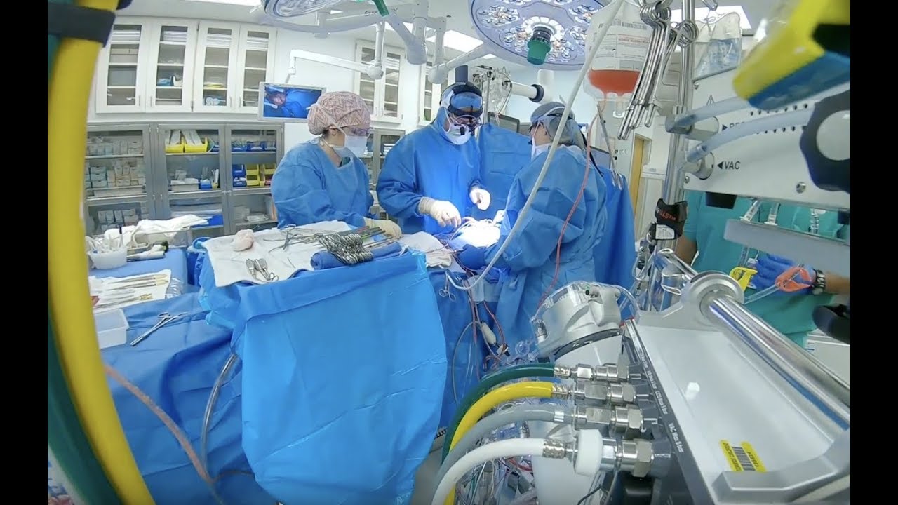 You are currently viewing Cardiac surgery Video – 6