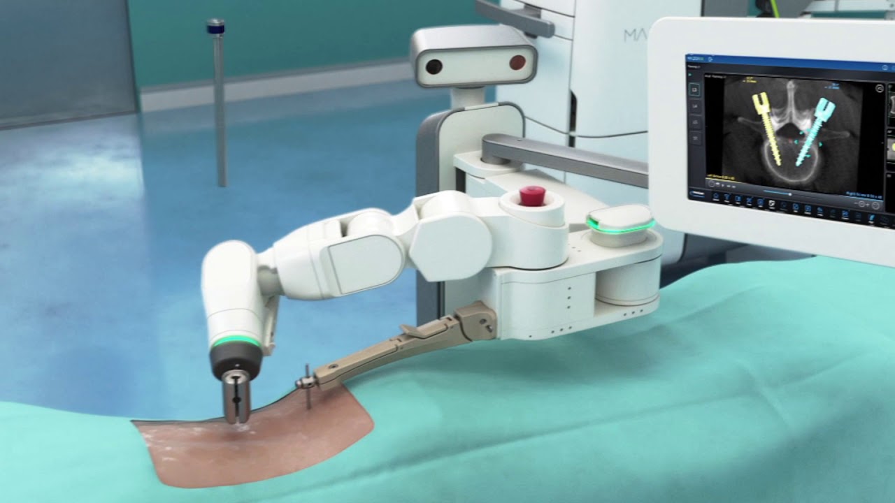 You are currently viewing Robotics Surgeries Video – 6
