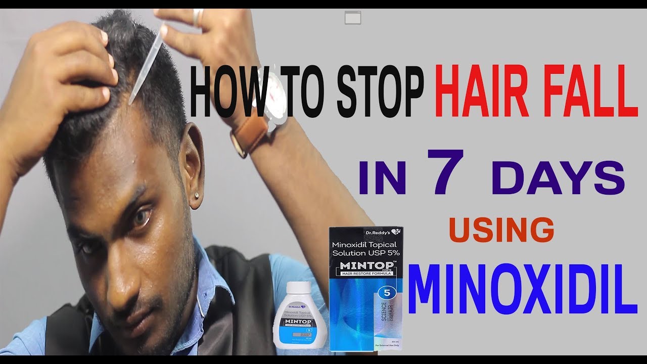 You are currently viewing STOP HAIR FALL in 7 days | MEN’S FASHION TAMIL