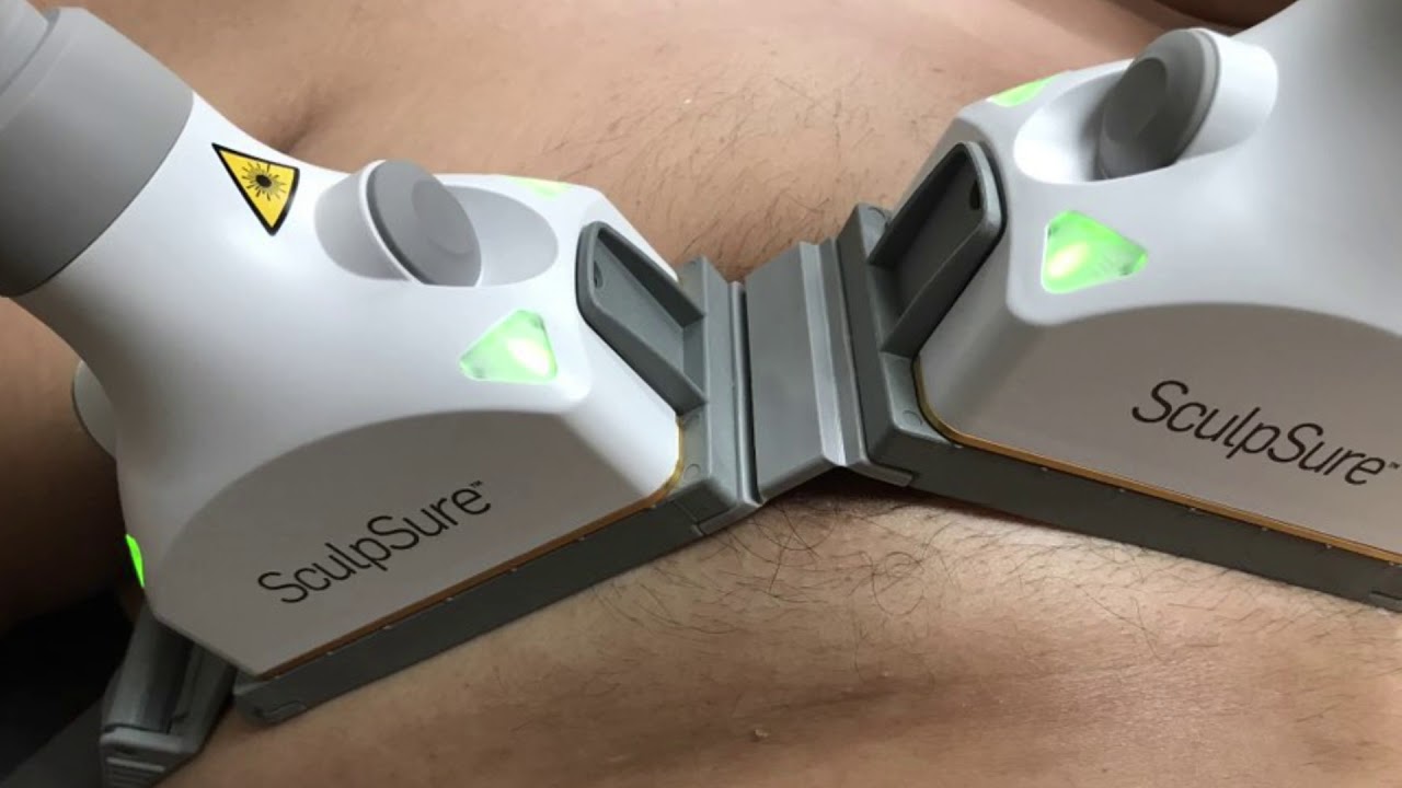 You are currently viewing SculpSure for Treatment of Grade I Gynecomastia