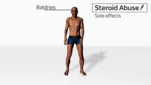 Anabolic Steroids – History, Definition, Use & Abuse Video – 31