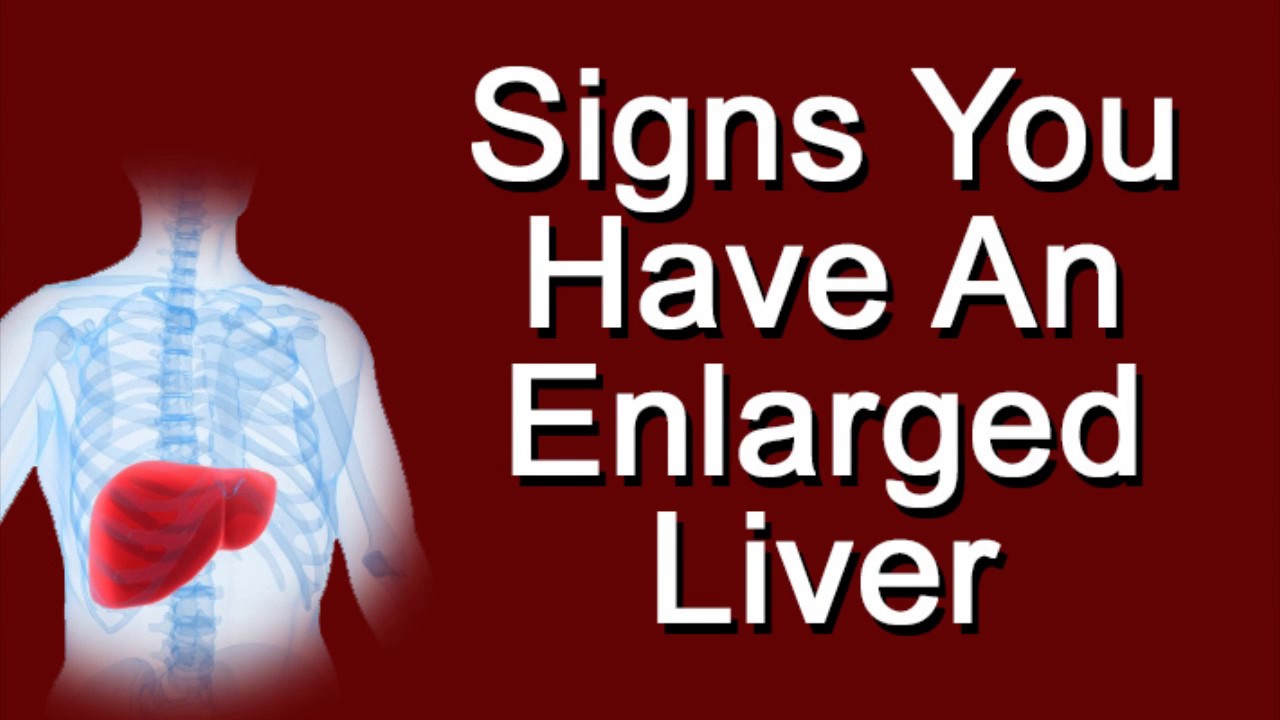 You are currently viewing Signs You Have An Enlarged Liver