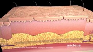 Dermatology/Skin Surgeries Video – 1
