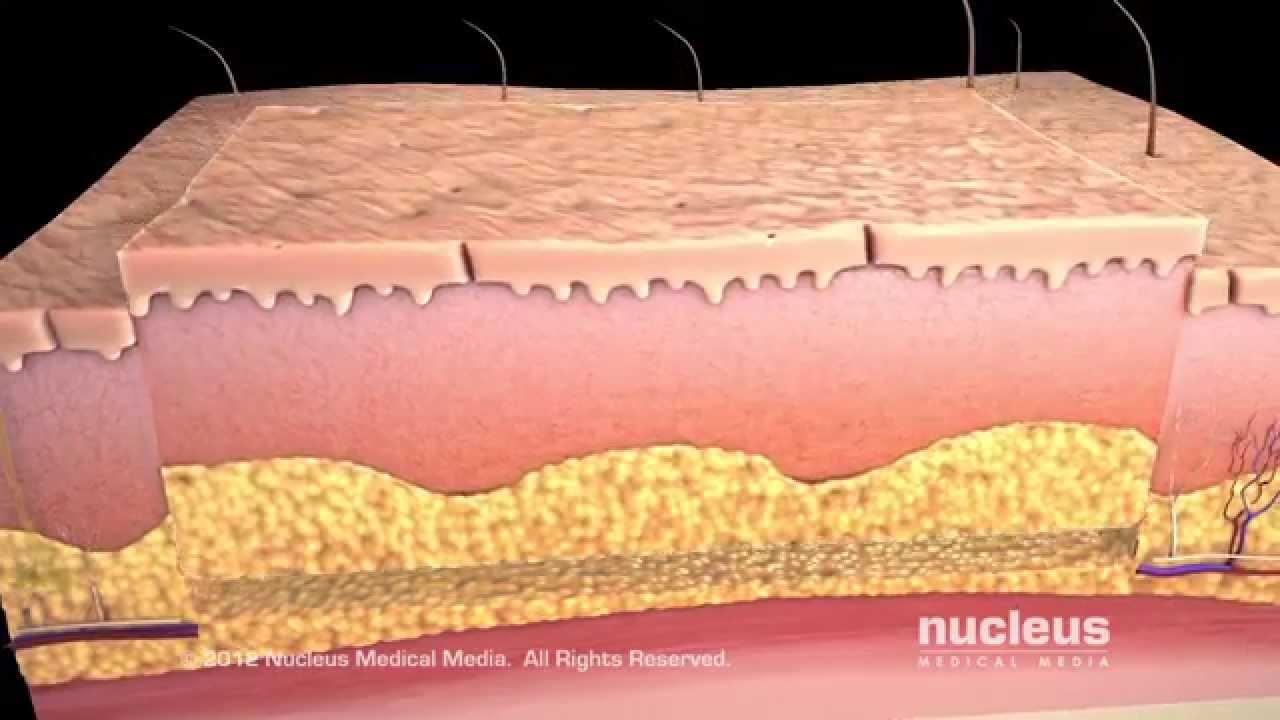 You are currently viewing Dermatology/Skin Surgeries Video – 1