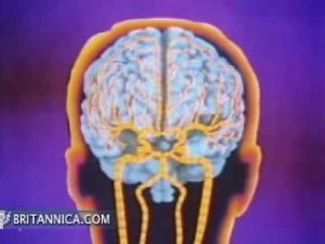 Read more about the article Strokes: Brain Damage