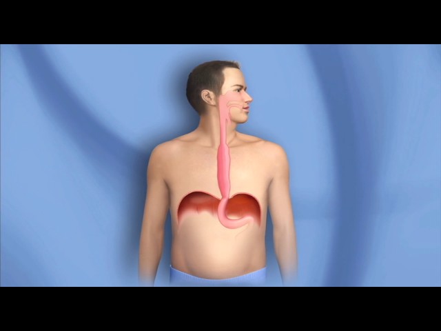 You are currently viewing Onco Surgery Video – 3