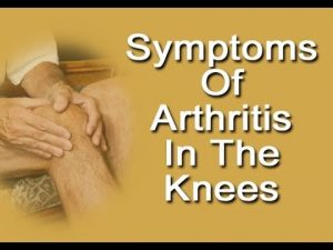 Symptoms Of Arthritis In Knees