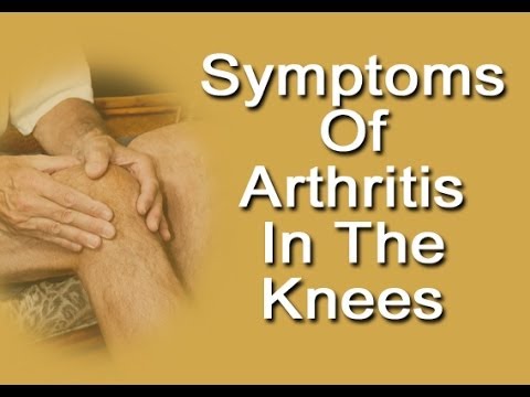 You are currently viewing Symptoms Of Arthritis In Knees