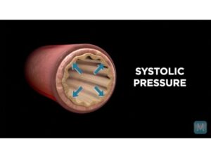 Read more about the article Systole vs. Diastole | Match Health