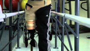 Read more about the article Physiotherapy in Rehabilitation Video – 1