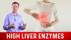 Read more about the article The Main Causes of High Liver Enzymes & Non-Alcoholic Fatty Liver Disease – Dr.Berg