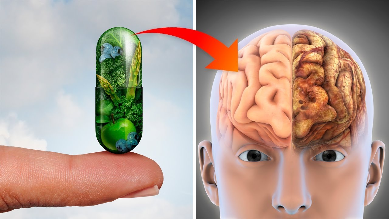 You are currently viewing These 3 Vitamins May Stop Brain Loss And Prevent Alzheimer’s Disease